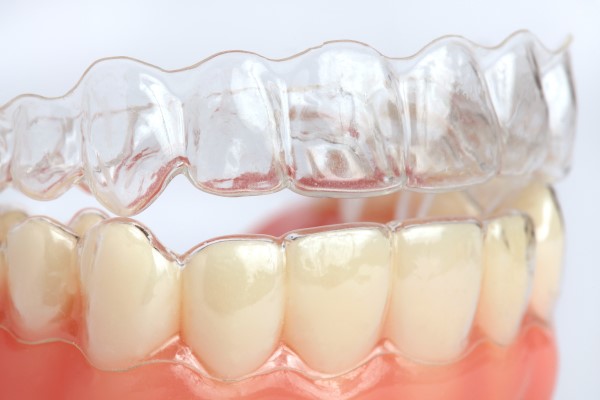 The Complete Beginner’s Guide To Clear Aligners